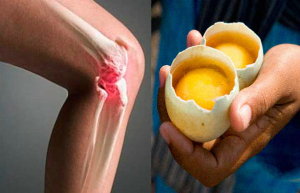 How To Use 2 Eggs To Disappear The Pain of Knees Completely and Repair The Joints