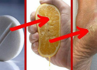 Dermatologists Are Angry In Silence, This Removes The Calluses and Fungi of The Feet In 2 Days