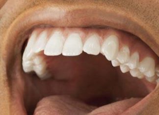 7 Influences of cigarettes in the oral cavity