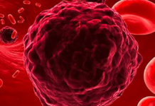 MRI Shows Cancer Cells THRIVE On Processed Sugar