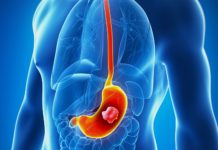The Scientist Found That This Vitamin Prevents The Risk Of Stomach Cancer