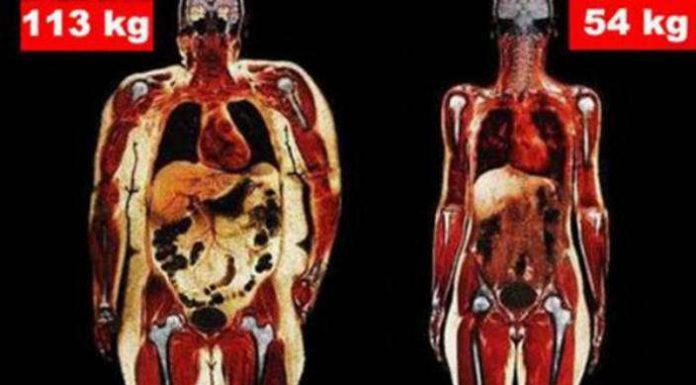 Two Different Bodies of the Same Age and Height