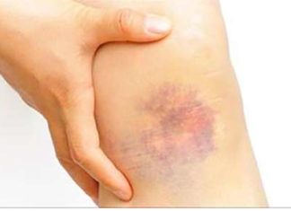 20 Warning Signs of Cancer Too Many Women Ignore
