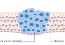 CONFIRMED: Cancer Is a Man-Made Disease, Your Lifestyle Causes Cancer Not Your Genetics