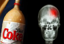 New Study: Diet Drinks Triple The Risk Of Getting Stroke And Dementia
