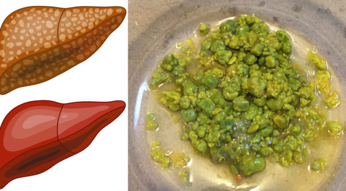 This Liver Detox Procedure Only Needs One Ingredient