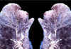 This Is What Happens to Your Lungs When You Diffuse Essential Oils