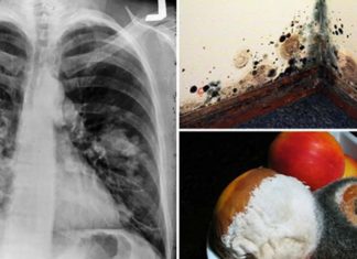 How to Reduce and Treat Toxic Mold Exposure in Your Everyday Life