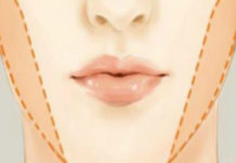 Lose The Fat From This Area Of The Face With These Super Easy Tricks