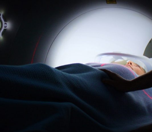 Mesothelioma MRI